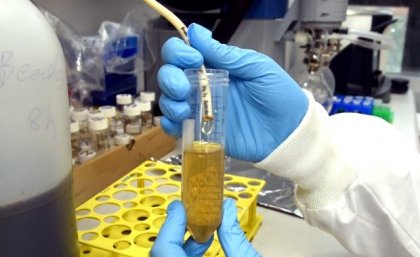 hands in blue gloves hold a small vial containing yellow liquid and white hose